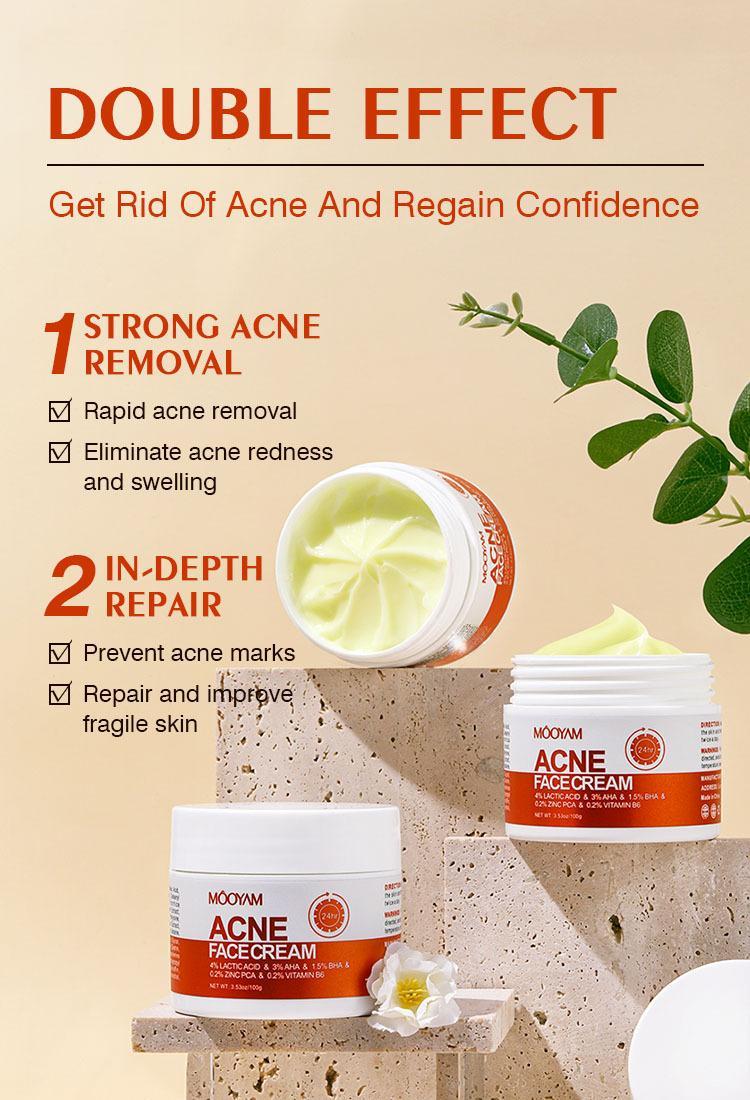 Teen Pimple Acne removal Cream 100g Spot Remover Skin Care Solution