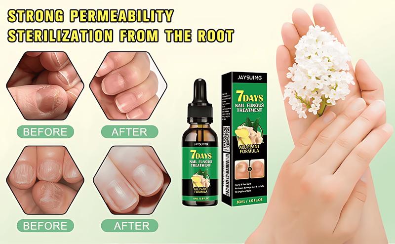 7-Day Nail Fungal Treatment Serum Foot Fungus Remedy Removal Products Anti infection Onychomycosis Paronychia Repair Gel Care Ginger Healthcare Therapeutic Therapy Bathroom Solution nailgrowthoil Healthy Wellness Aid Liquid Fitness Organic Skin Ginkgo