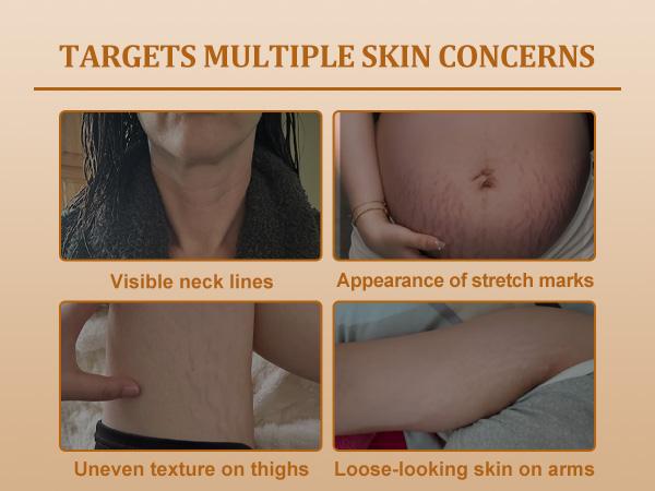 (Upgraded) YCZ Neck Firming Cream with New Formula | Deep Moisturizing for Crepey Skin on Neck, Arms, Thighs & More | Firming & Lifting | Cruelty-Free Skincare (Upgraded) YCZ Neck Firming Cream with New Formula | Deep Moisturizing for Crepey Skin on Neck, Arms, Thighs & More | Firming & Lifting | Cruelty-Free Skincare