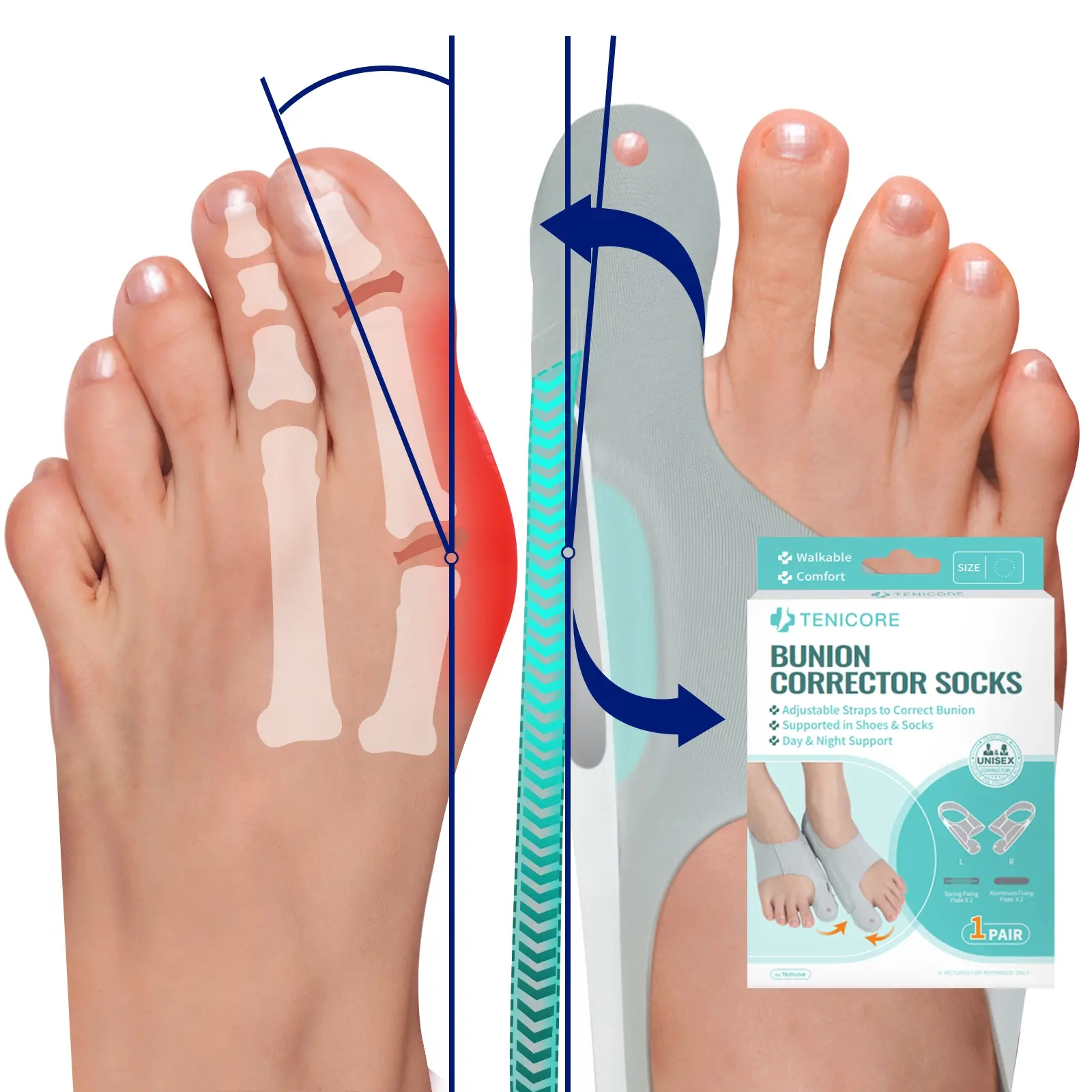 Adjustable Bunion Corrector Socks, Orthopedic Toe Straightener, Big Toe Alignment Sleeve, Toe Separation, Toe Separator, 1 Pair with 4 Fixing Plates, Day & Night Foot Pain Relief, Comfortable Shoe Inserts for Bunions, Foot Care Product