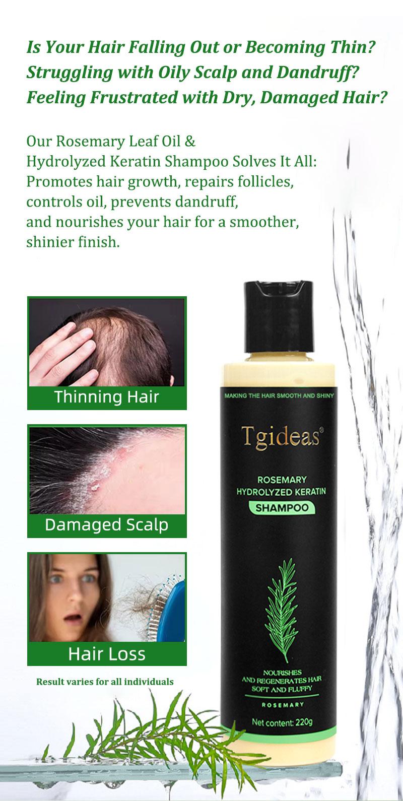Tgideas Rosemary Shampoo - BoostHair Growth, Control Oil & Dandruff,Soothe Scalp lritation & RestoreShine! Outdoorfun Hydrolyzed Keratin