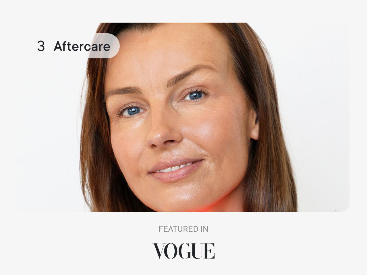 Qure Micro-Infusion Anti Wrinkle Patches for Smile Line, Frown lines, Under Eye Bags, Puffiness, Crow's Feet - Retinol, Niacinamide, Caffeine, Peptides - Dissolvable for Overnight Use - 8 Pairs