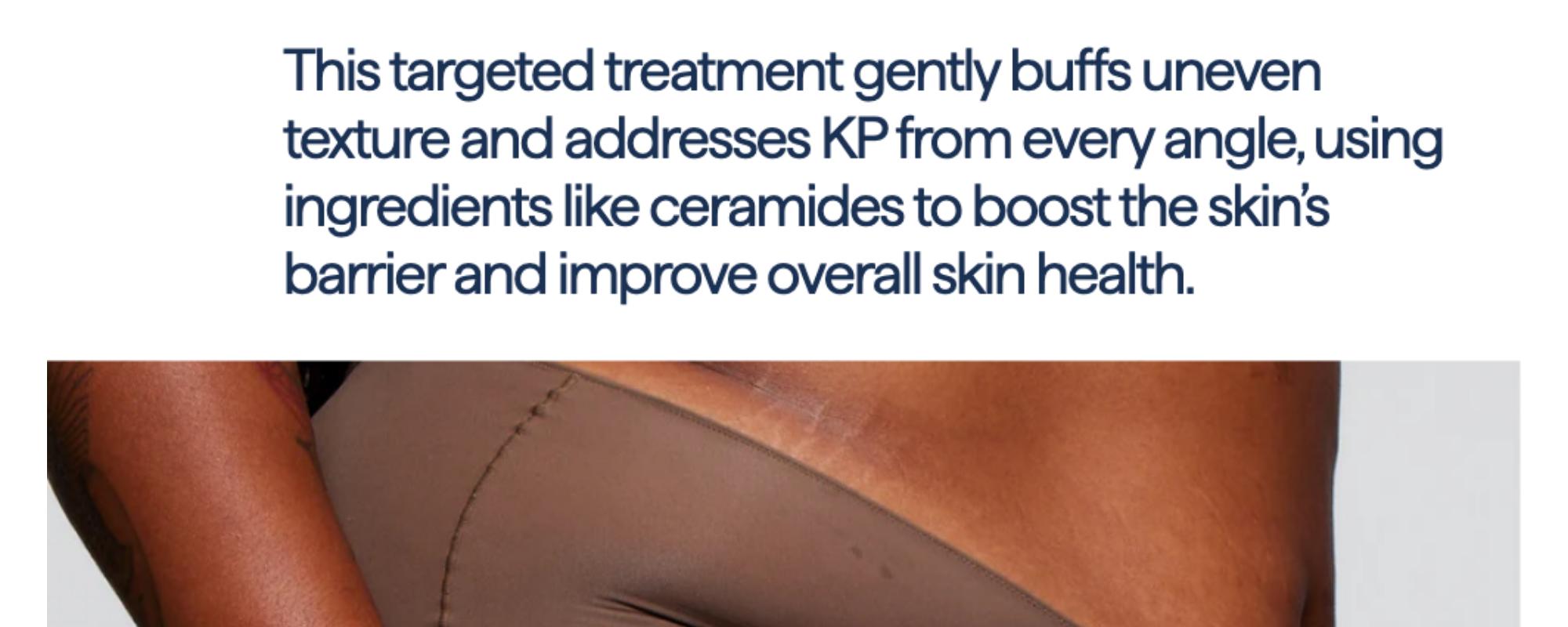 REMEDY for Body Bumps - KP Exfoliating Body Moisturizer