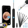 Portable Type-C Rechargeable Ear Wax Removal Tool Kit with 1080P HD Camera, LED Lights - IP67 Waterproof Endoscope, Silicone Ear Pick, Storage Box, Long-Lasting Batteries - Personal Care Gadgets, Gifts for Adults (1 Set)