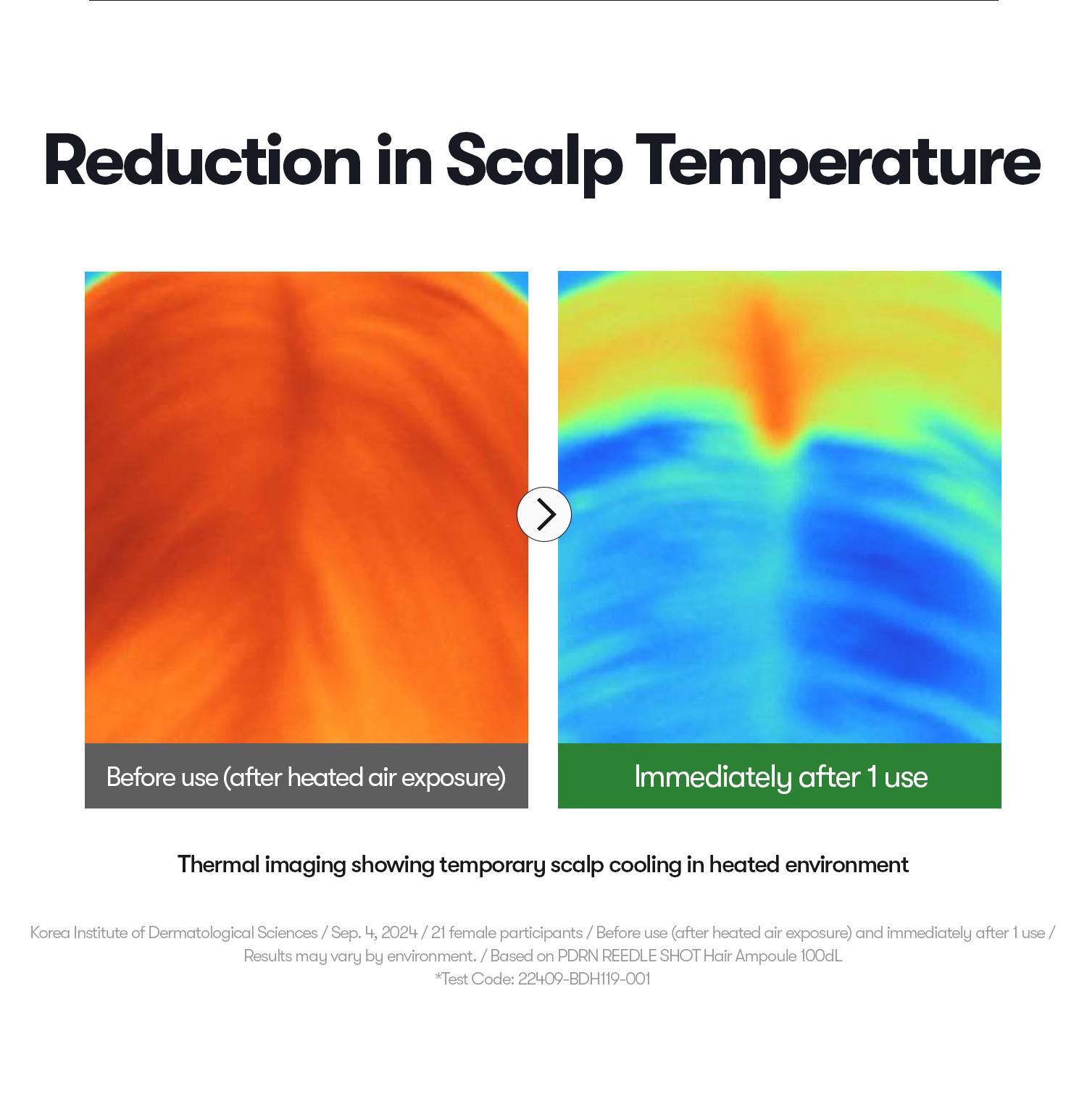 [VT Official] PDRN Reedle Shot Hair Ampoule | Hair Growth Hair loss treatment, Hair Loss Prevention, Scalp Health, OG Liquid Microneedling Reedle Shot, Enhanced Absorption Hair Serum Shot, PDRN & Caffein & Biotin & Rosemary Extract, Anti-aging Scalp No Ri