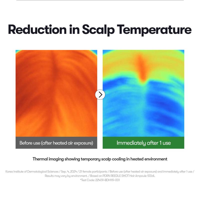 [VT Official] PDRN Reedle Shot Hair Ampoule | Hair Growth Hair loss treatment, Hair Loss Prevention, Scalp Health, OG Liquid Microneedling Reedle Shot, Enhanced Absorption Hair Serum Shot, PDRN & Caffein & Biotin & Rosemary Extract, Anti-aging Scalp No Ri