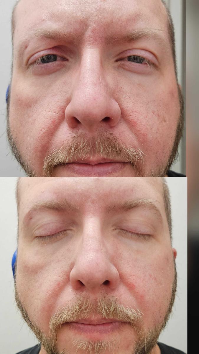 Item: Peel Shot Duo Set(white rice+ black rice)