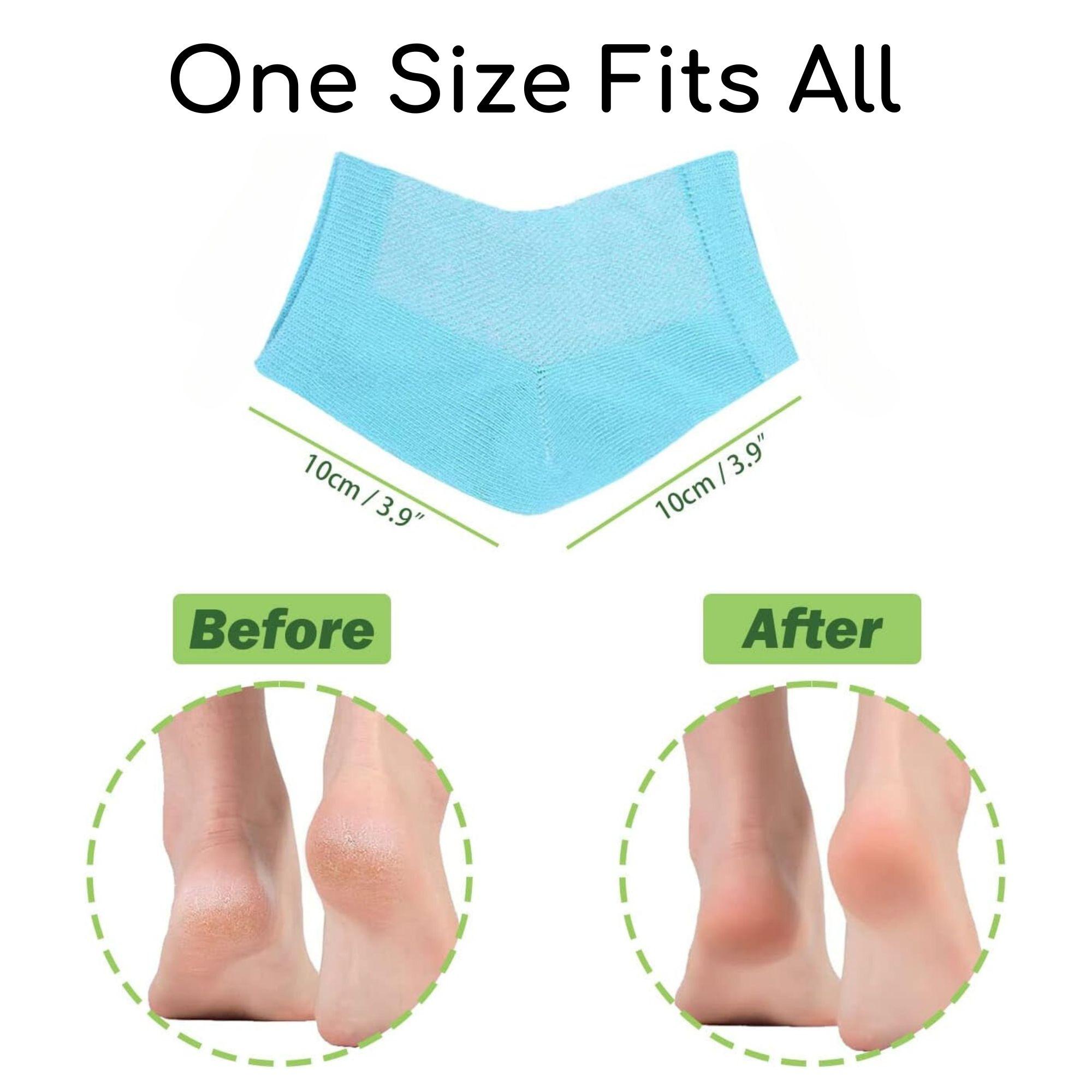 AloeSoft Women's Aloe Vera Heel Socks for All Seasons - Moisturizing Soft Healing Socks - Hydrates Dry Cracked Feet
