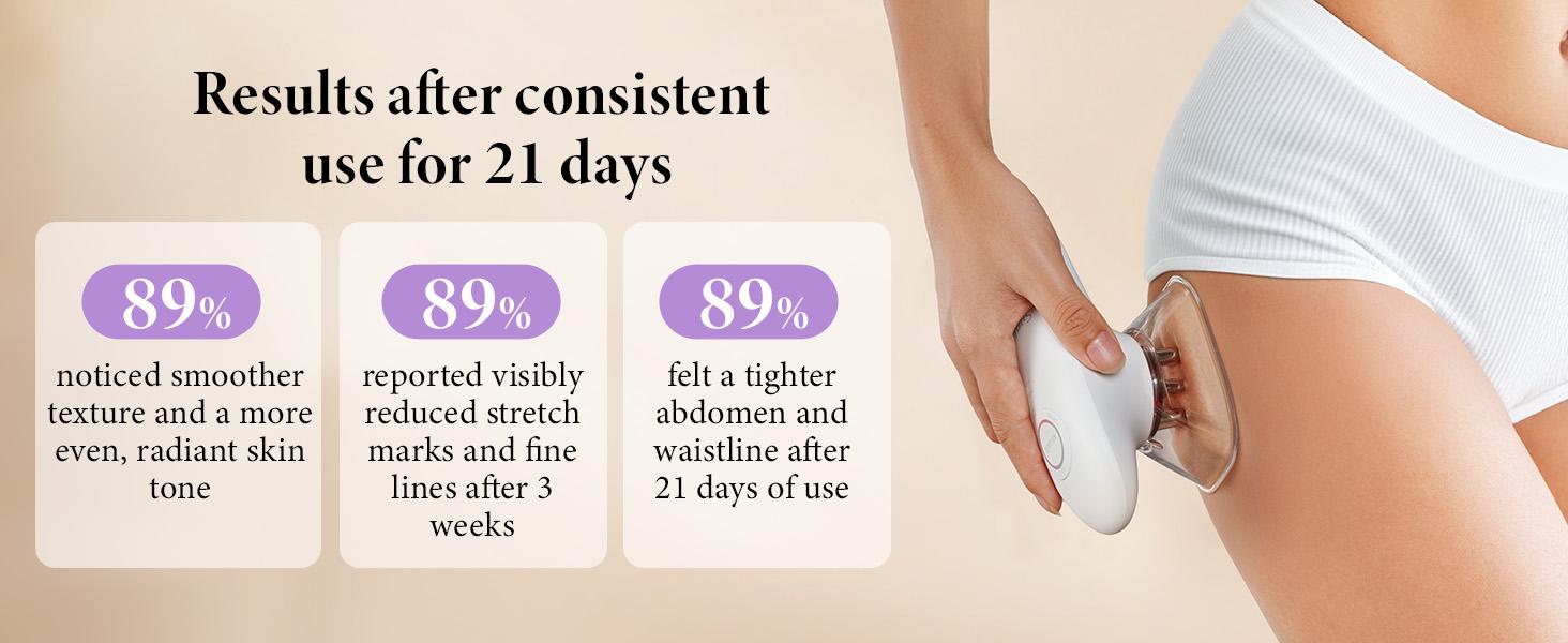 SunLuxy 3-in-1 Red Light Therapy & Cupping Suction Machine for Relaxation, Skin Rejuvenation, and Facial Firming – Perfect Valentine’s Day Gift – 3 Power Levels, Ergonomic Design, Type-C Charging