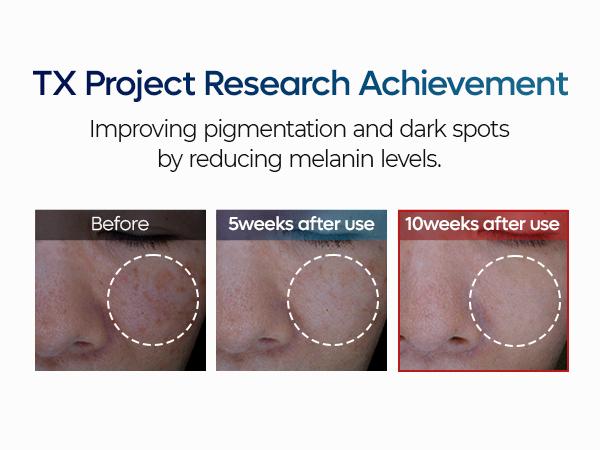 [Dr.Melaxin Official] TX Tranexamic Acid Dark Spot Care Line | TX Ampoule Cleanser + Peeling Toner + Ampoule Rx + Cream | Dark Spot, Brightening