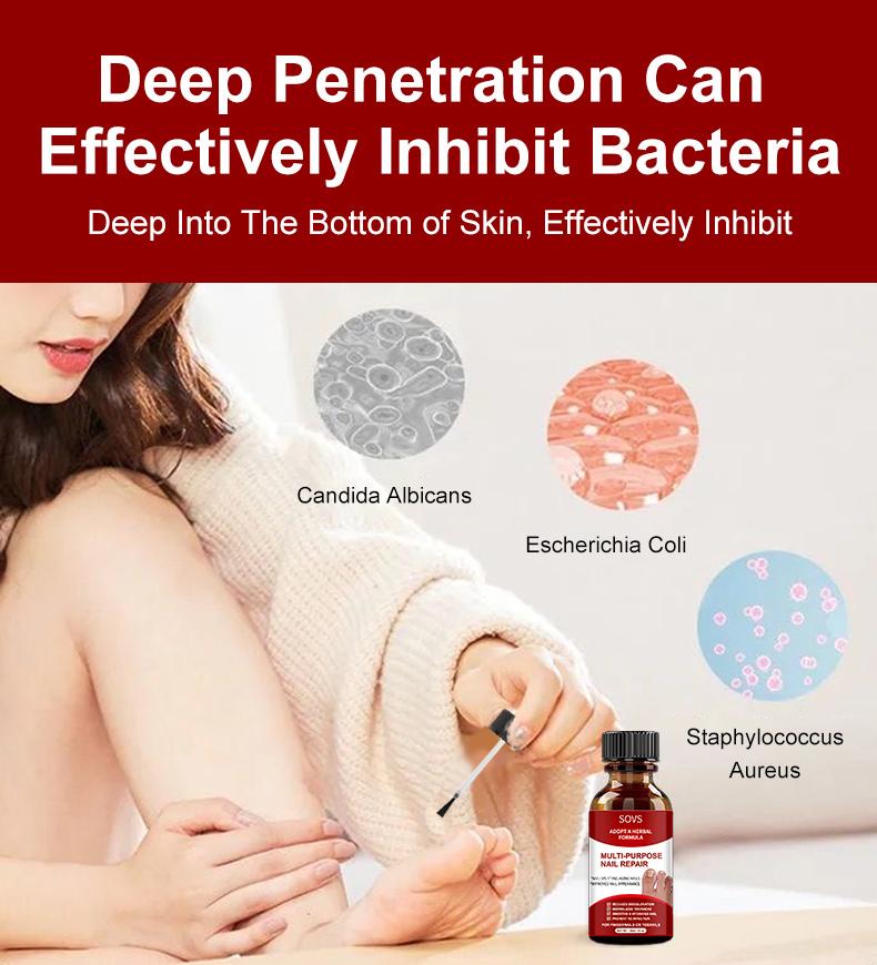 SOVS Toenail Fungus Treatment Extra Strength ,Antifungal Solution ,Triple Action Formula for Damaged Nails, Multi-Purpose Nail Repair,1 Fl Oz Manicure Therapy