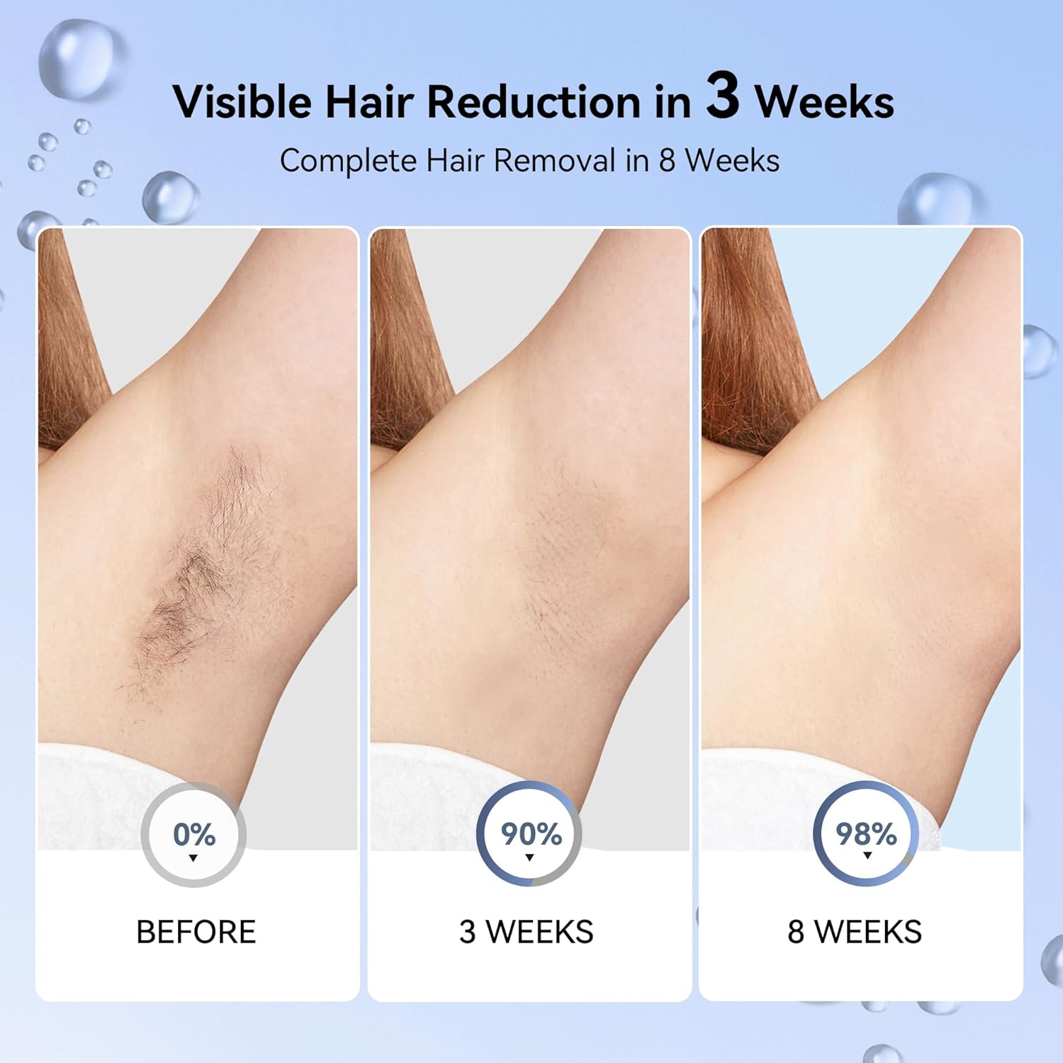 KESILY by OVUTEK Laser Hair Removal IPL for Women and Men, Sapphire Ice-Cooling, Nearly Painless and Permanent Hair Removal Device at Home Comfort