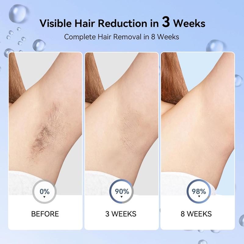 KESILY by OVUTEK Laser Hair Removal IPL for Women and Men, Sapphire Ice-Cooling, Nearly Painless and Permanent Hair Removal Device at Home Comfort KESILY by OVUTEK Laser Hair Removal IPL for Women and Men, Sapphire Ice-Cooling, Nearly Painless and Permanent Hair Removal Device at Home Comfort