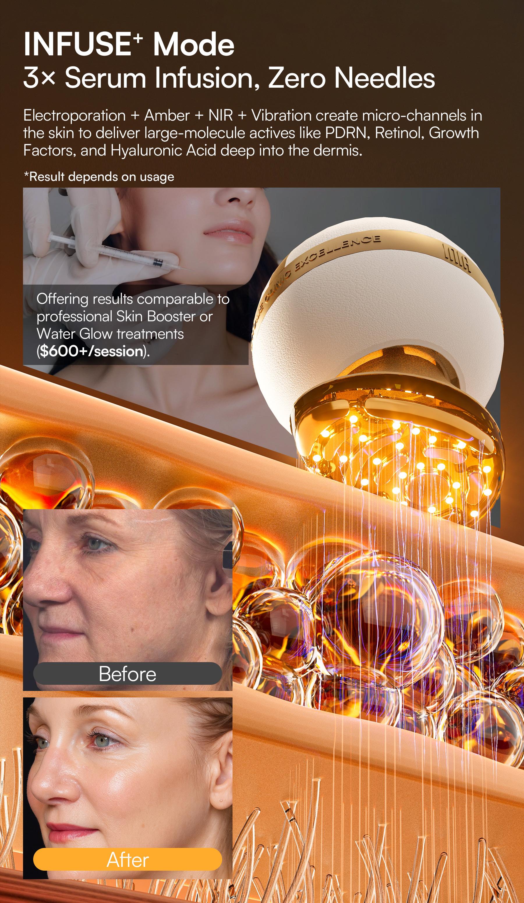 INIA SPHERA At-Home RF & LED Anti-Aging Facial Device – Lift, Tighten & Sculpt with EMS Microcurrent, Red Light Therapy, Electroporation & Cryo Cooling for Firm, Glowing Skin, Best Valentine's Day Gift for Her