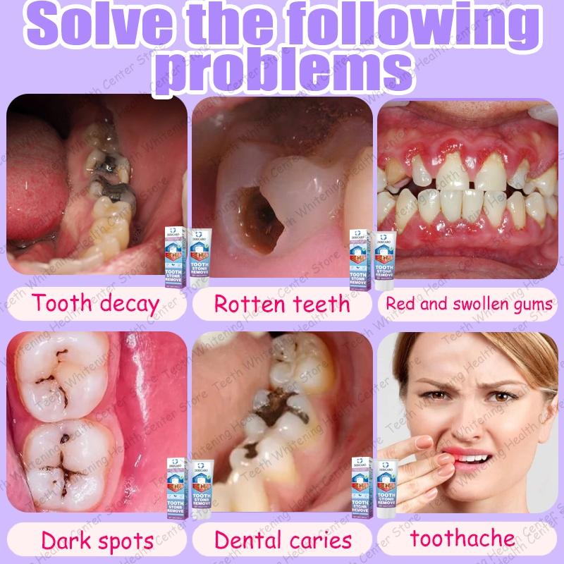 ZKRICARO Anti-Cavity Repair Toothpaste FDA Certified Cavity Repair Whitens Teeth Strengthens Enamel Relieves Sensitivity & Bad Breath ZKRICARO Anti-Cavity Repair Toothpaste FDA Certified Cavity Repair Whitens Teeth Strengthens Enamel Relieves Sensitivity & Bad Breath