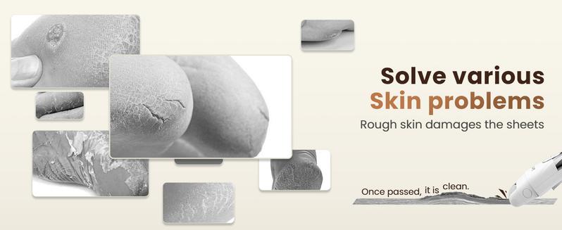 ElectricFoot Callus Remover, RechargeablePortable Electronic Foot File PedicureSet, Waterproof Foot Scrub File,Professional Pedicure Tools, ldeal Giftfor Summer Foot Dead Skin Care, 3Rollers