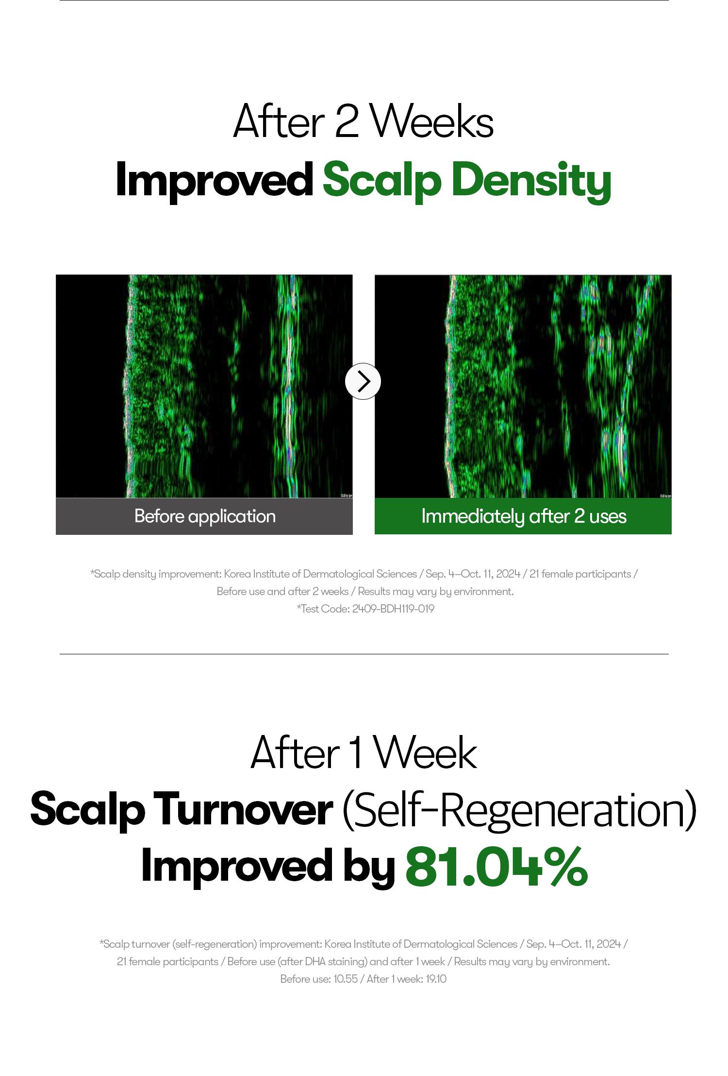 [VT Official] PDRN Reedle Shot Hair Ampoule | Hair Growth Hair loss treatment, Hair Loss Prevention, Scalp Health, OG Liquid Microneedling Reedle Shot, Enhanced Absorption Hair Serum Shot, PDRN & Caffein & Biotin & Rosemary Extract, Anti-aging Scalp No Ri