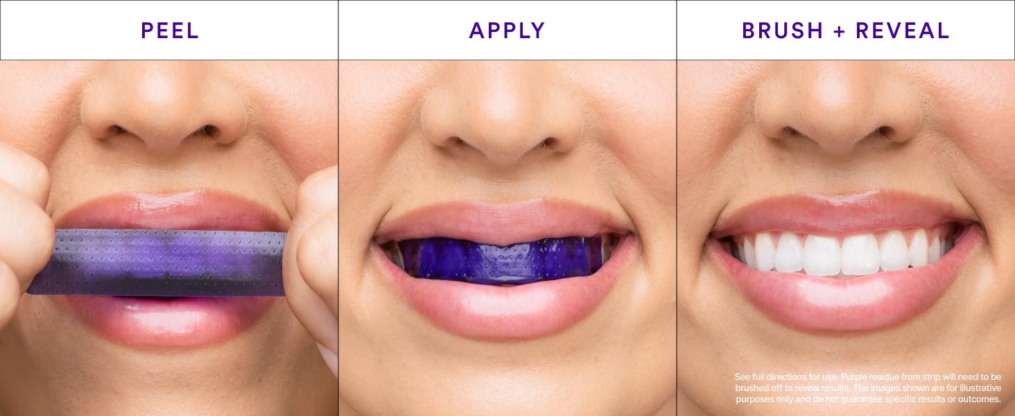 Hismile Viral V34 Duo - Teeth Whitening Strips & Colour Corrector Serum, Temporary Colour Correction, Whitening in 30 Minutes