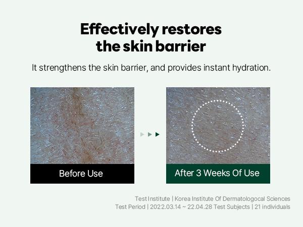 Pine Calming Cica Ampoule - 30ml for Skin Repair and Redness Care