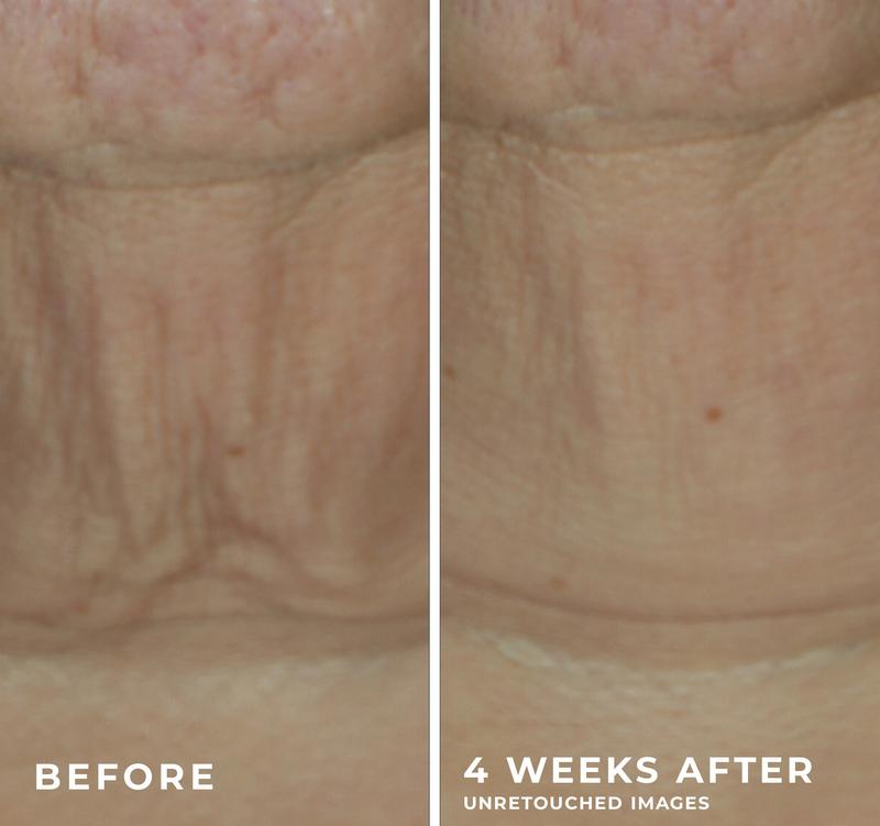 [RoC Skincare] DERM CORREXION Firming Serum Stick