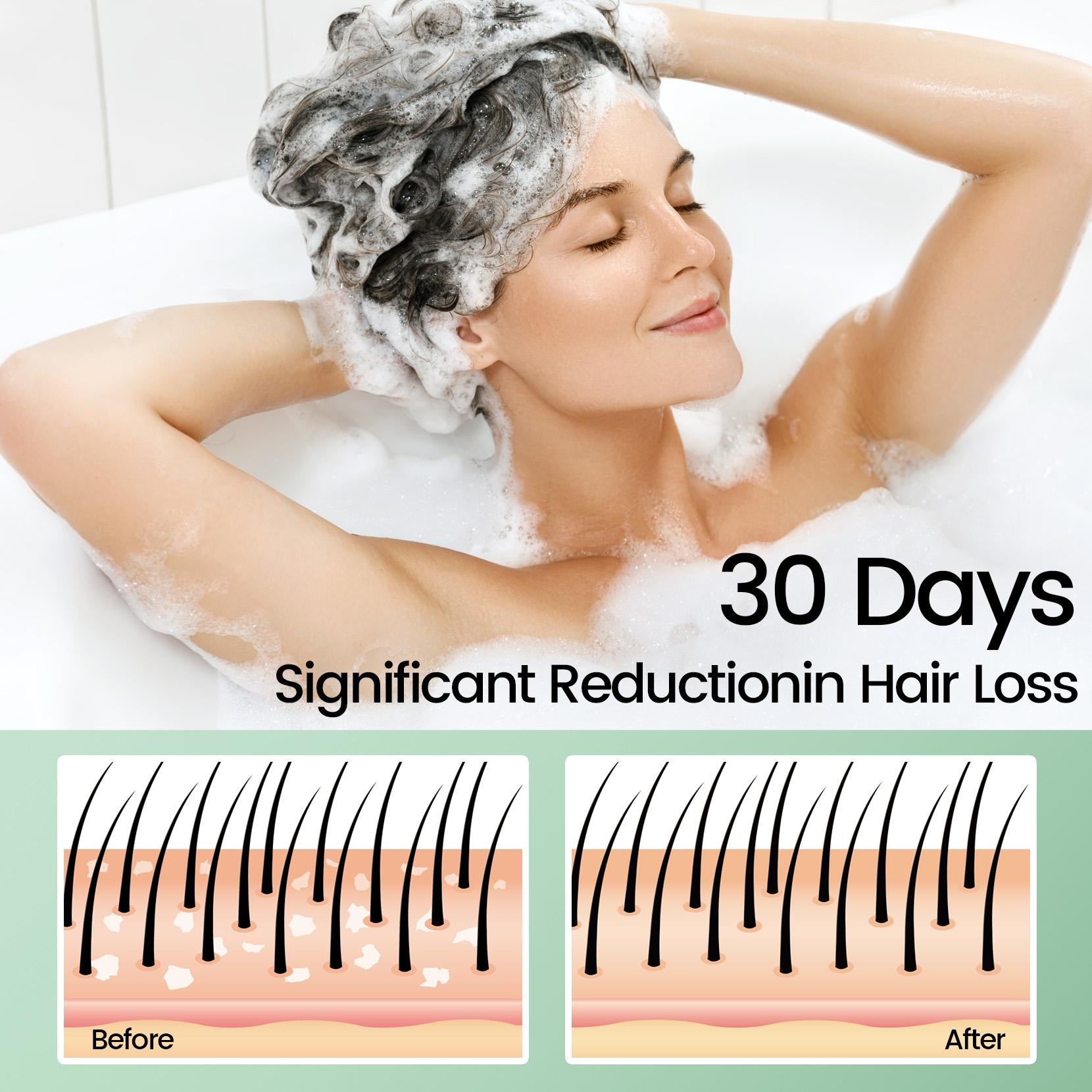 Sysni Organic Rosemary Shampoo and Tea Tree Special Shampoo, keratin nourIshing shampoo ,Promote Hair Growth, Strengthening Shampoo, Prevent Hair Loss Cleansing Shampoo,Deep Cleans, Refreshes Scalp, For All Hair Types, Especially Oily Hair Rosemary Biotin