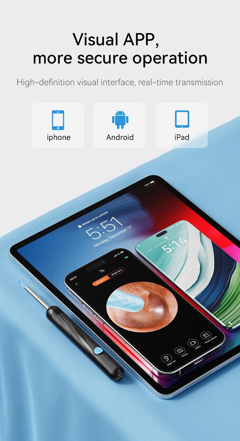 [Valentine's Day Gift] 1080P HD EarWax Removal Tool with Camera 6 Ear Spoons Set Rechargeable USB Battery Dual Power Safe Ear Care Gentle Round Handle Version