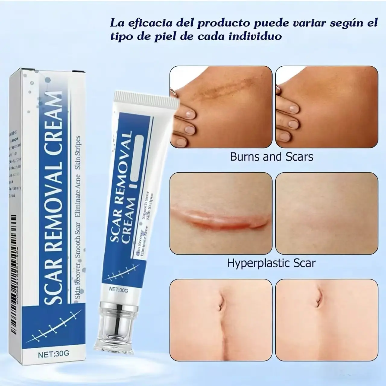 Professional Scar Removal Cream for Women - Advanced Silicone Skin Repair, Scar Care Body Lotions & Creams for Daily Burn Care, Fades Dark Marks on Face & Body, Eases Skin Irritation Scar Solution Silicone Scar Gel Scarbandage Scar Soothing Cream