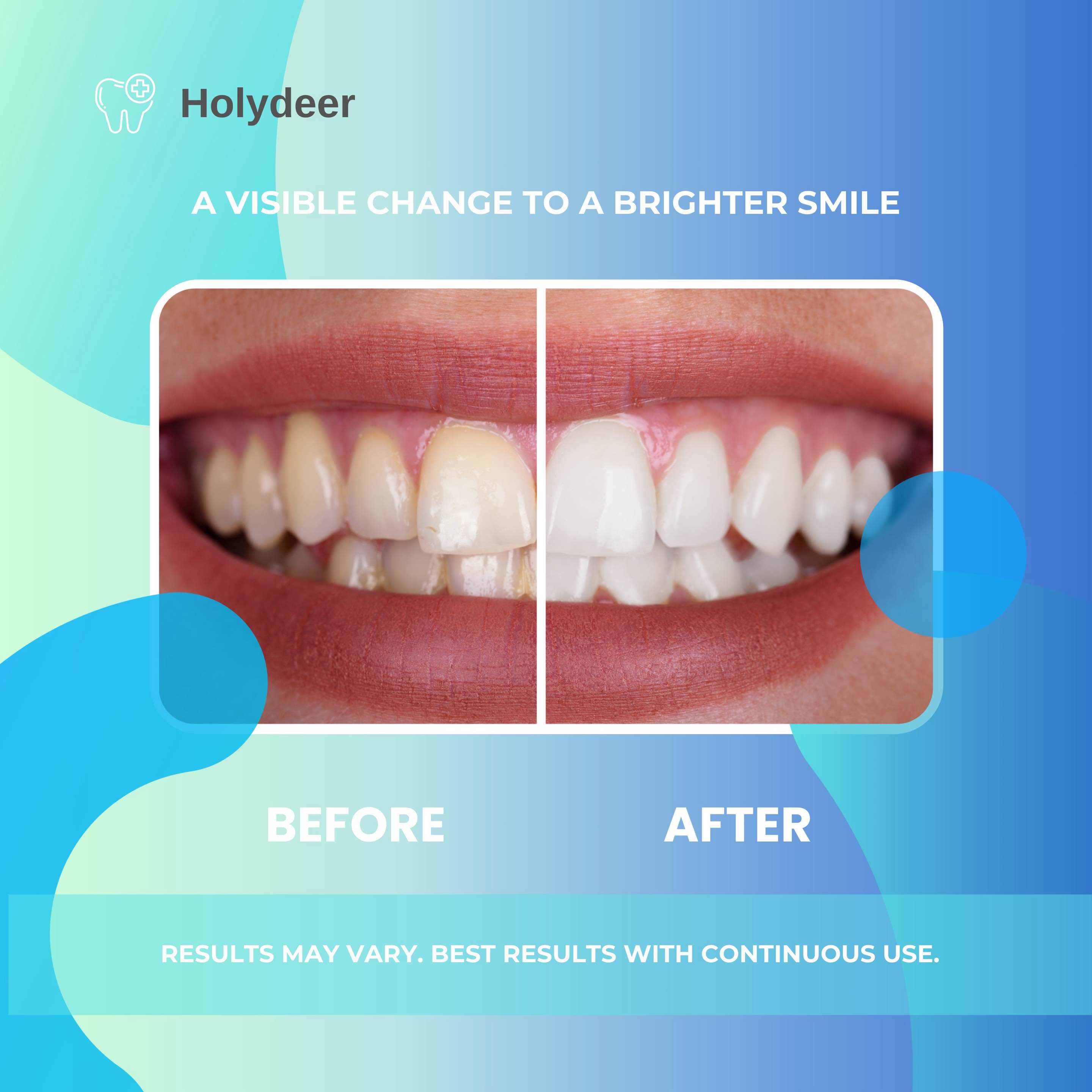 Holydeer Nano Hydroxyapatite Toothpaste - Advanced Enamel Repair & Sensitivity Care - Gentle Formula with Natural Peppermint Freshness - Fluoride-Free Daily Oral Care Whitening Kit Restore Sensitive Holydeer Nano Hydroxyapatite Toothpaste - Advanced Enamel Repair & Sensitivity Care - Gentle Formula with Natural Peppermint Freshness - Fluoride-Free Daily Oral Care Whitening Kit Restore Sensitive