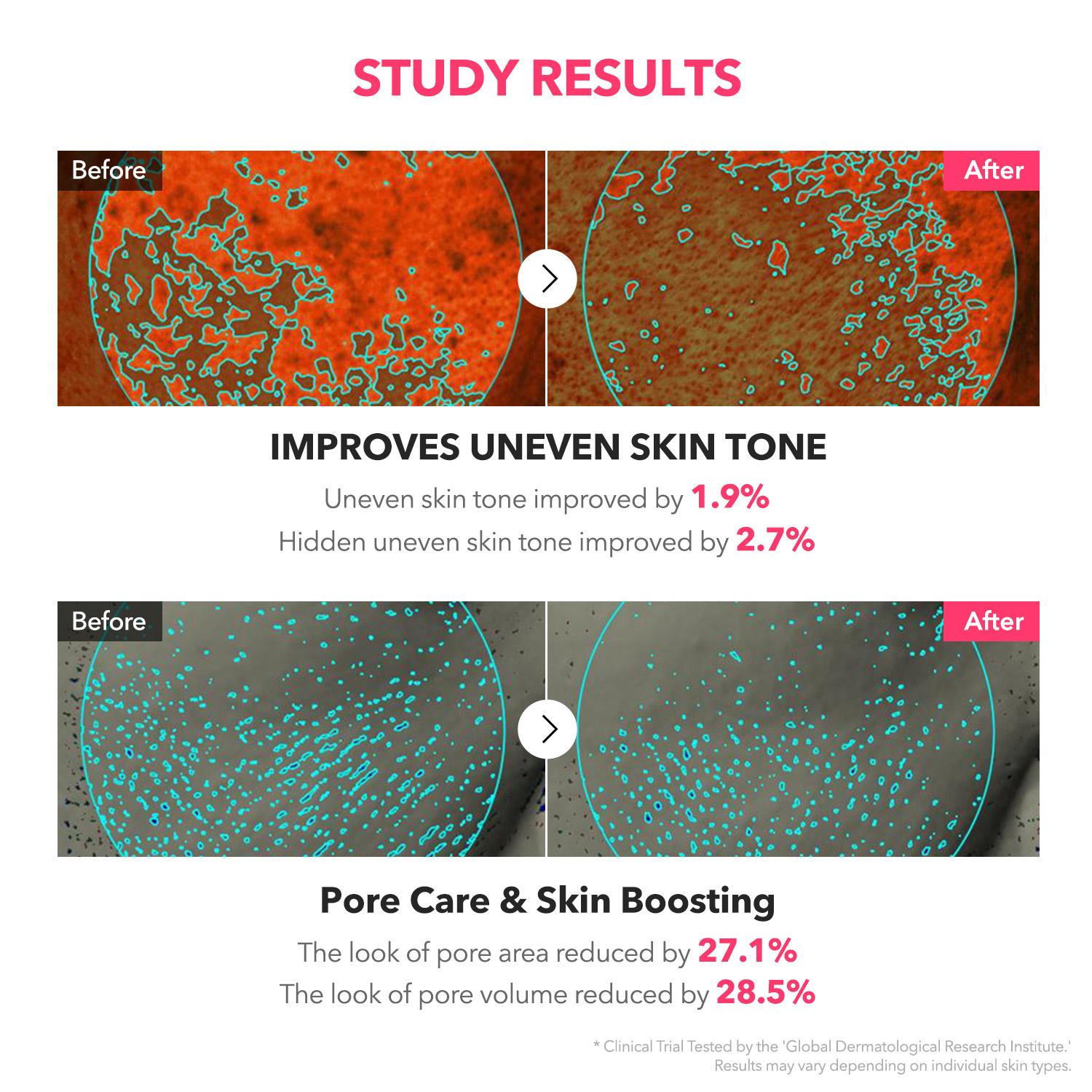 [APRILSKIN Official] TXA 99 Niacinamide Spicule Serum | Spicy Jelly Serum | Pink Tingling Serum | Uneven Skin Tone Correcting Serum | Korean Skincare Comfort