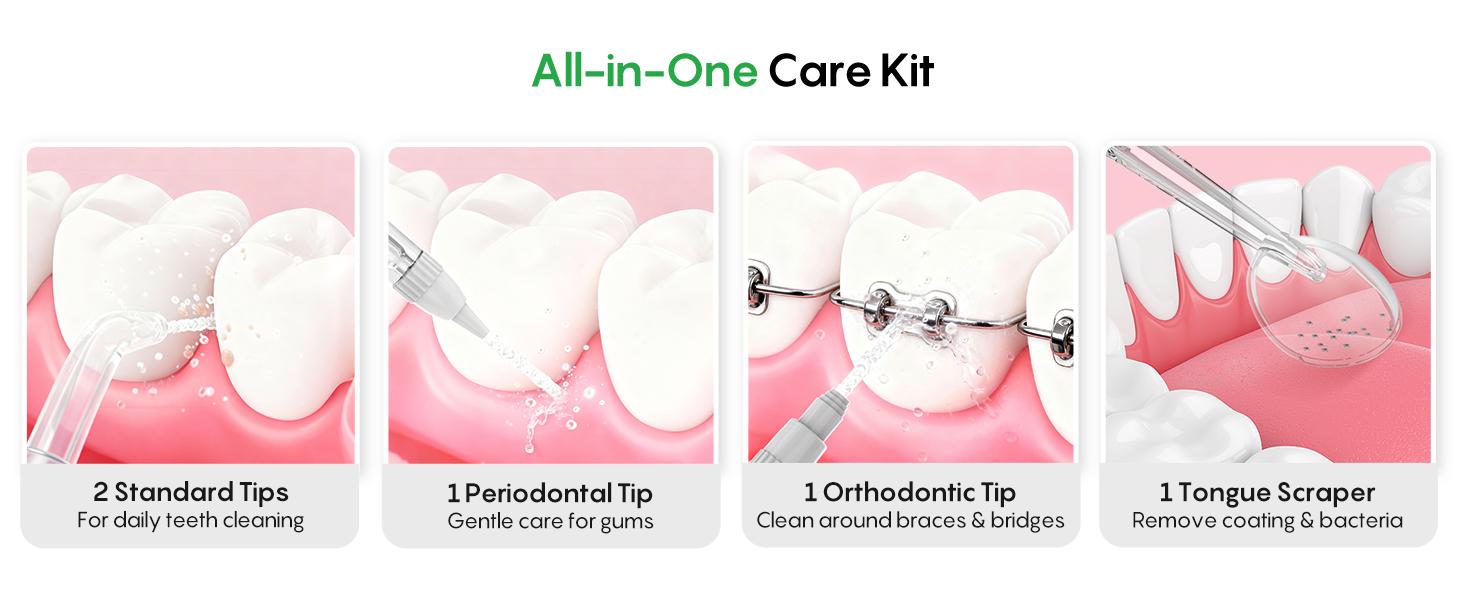 FRESKO Water Dental Flosser – 50-Day Battery, 10 oz Tank, 5 Tips, Waterproof & Gentle for Braces/Sensitive Gums