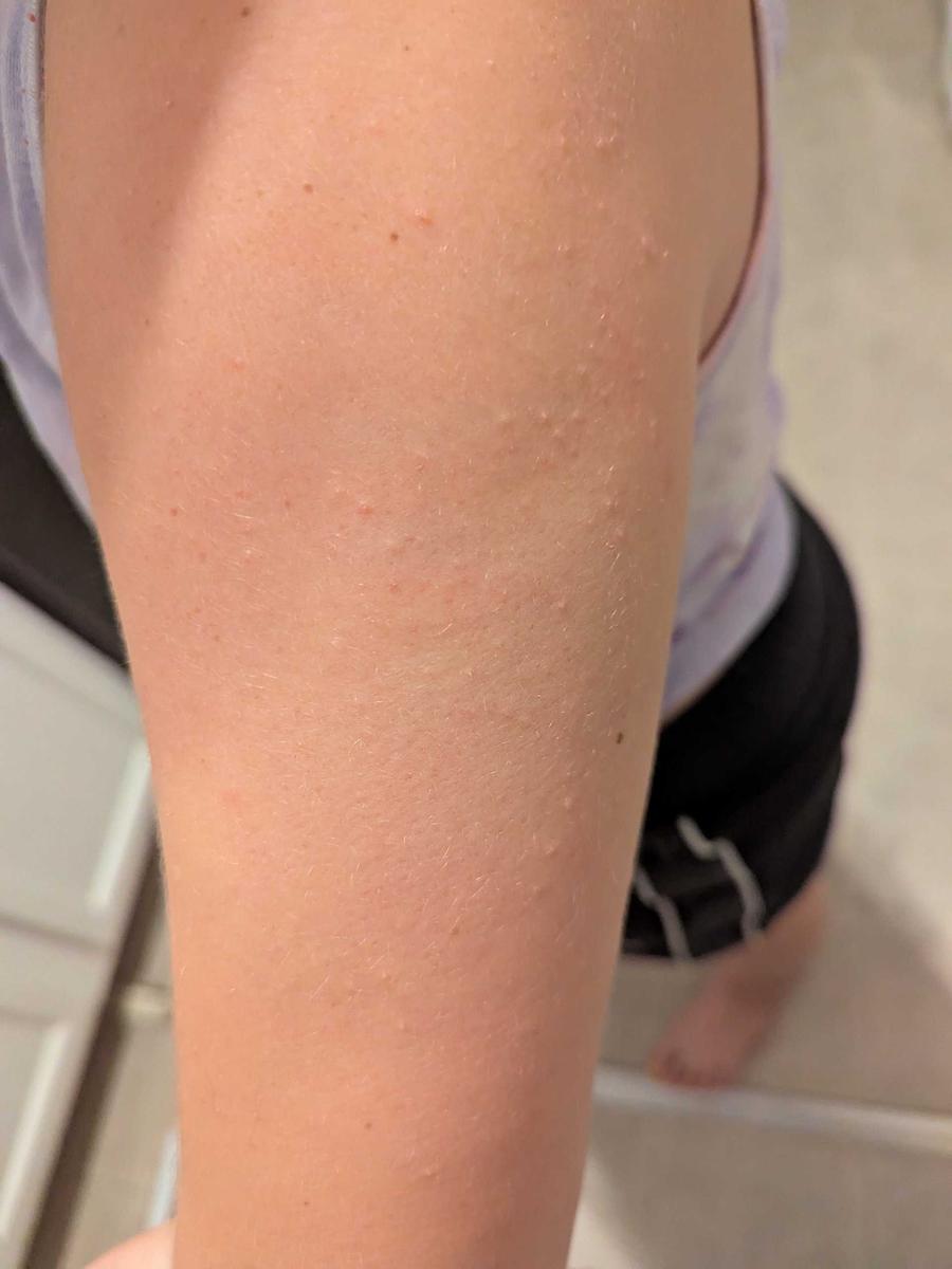 Item: Black Rice Peeling Ampoule + Body Peeling Spray