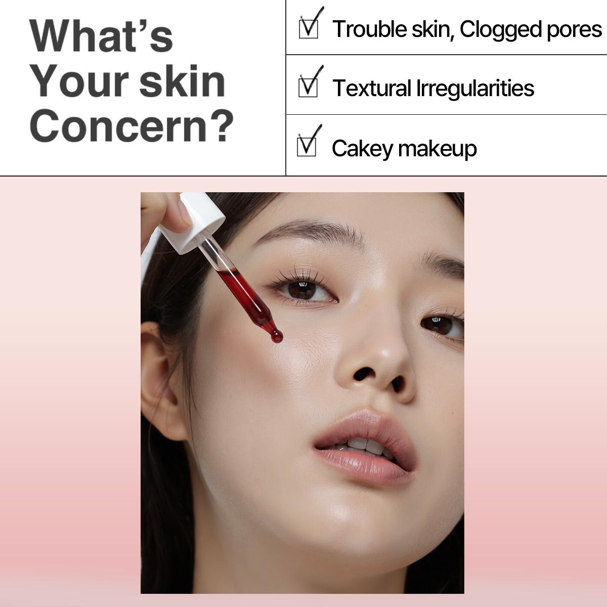 [Heimish RX] AHA BHA 30% Peeling Serum 35ml for Acne-Prone Skin Exfoliating Formula for Radiant Even Toned Skin & Clear Pores