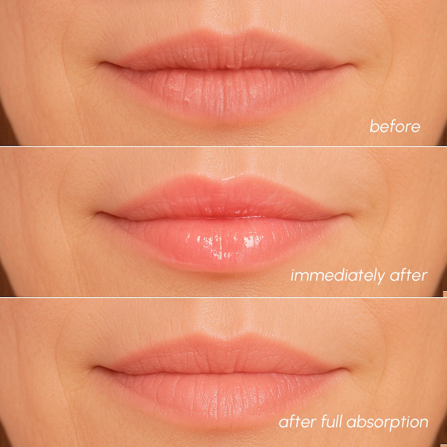 Lip Balm MARÉE 0.5 FL Moisturizing Butter Balm with Peptides Collagen & Shea Butter for Soft Plump Lips 15 ML