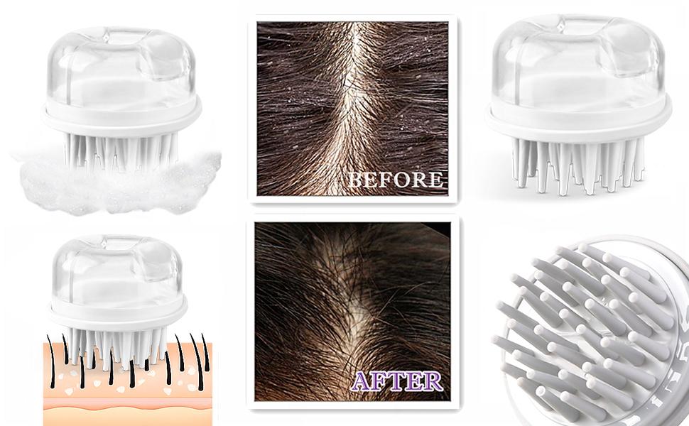 Dual-Effect Bristle Scalp Massage Comb: Dual-zone bristles for targeted care. Deep cleans hair follicles while soothing massage relieves tension. Strengthen roots starting with a healthy scalp. Available in white/pink/gray.