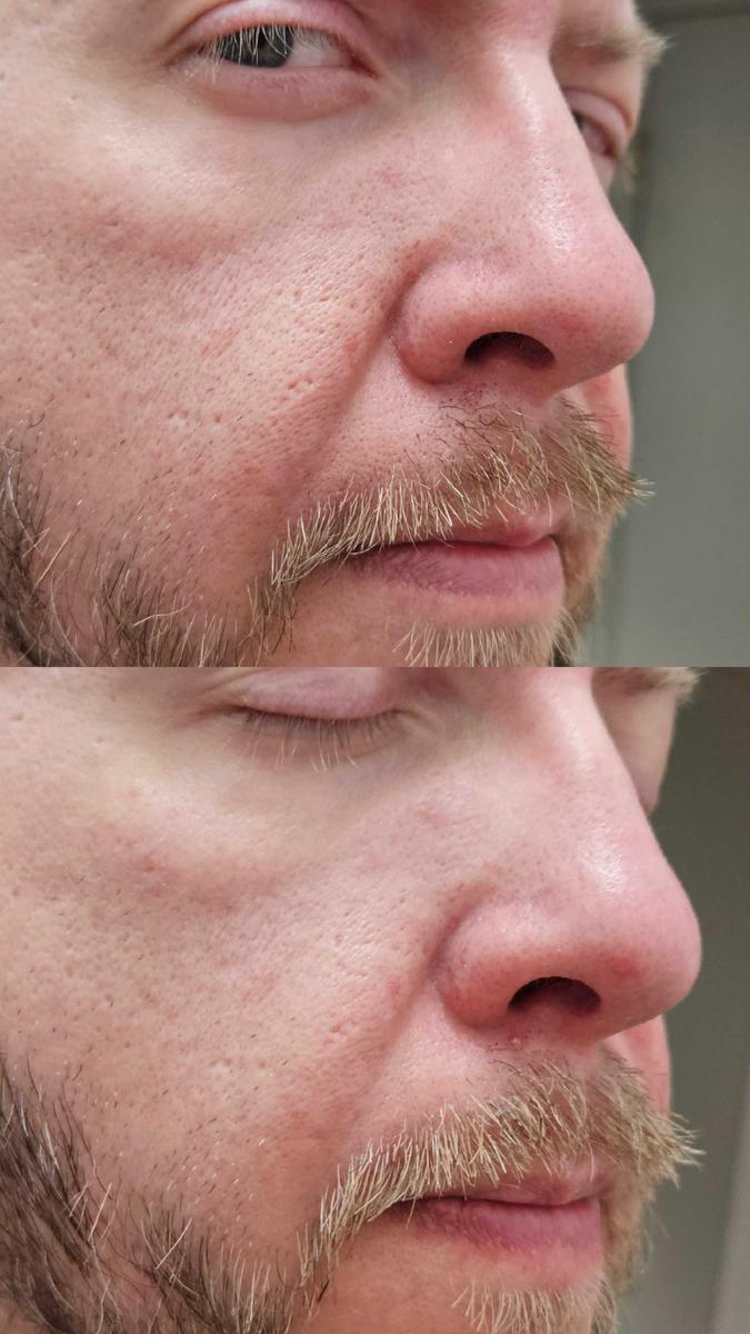 Item: Peel Shot Duo Set(white rice+ black rice)