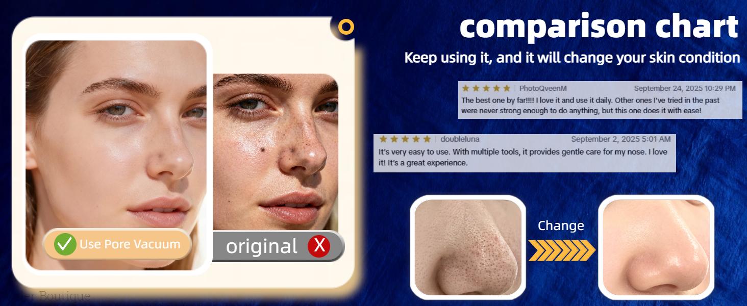 Blackhead Remover Pore Vacuum USB Rechargeable Blackhead extractor Facial Beauty Instrument Facial Beauty