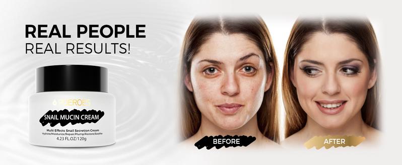 POEROES Ultra Moisturizing Snail Mucin 99.3% Moisturizing Gel for Dry & Sensitive Skin - 120g /4.23oz Cleansing Skin Care, Facial Lotion Moisturizer Comfort