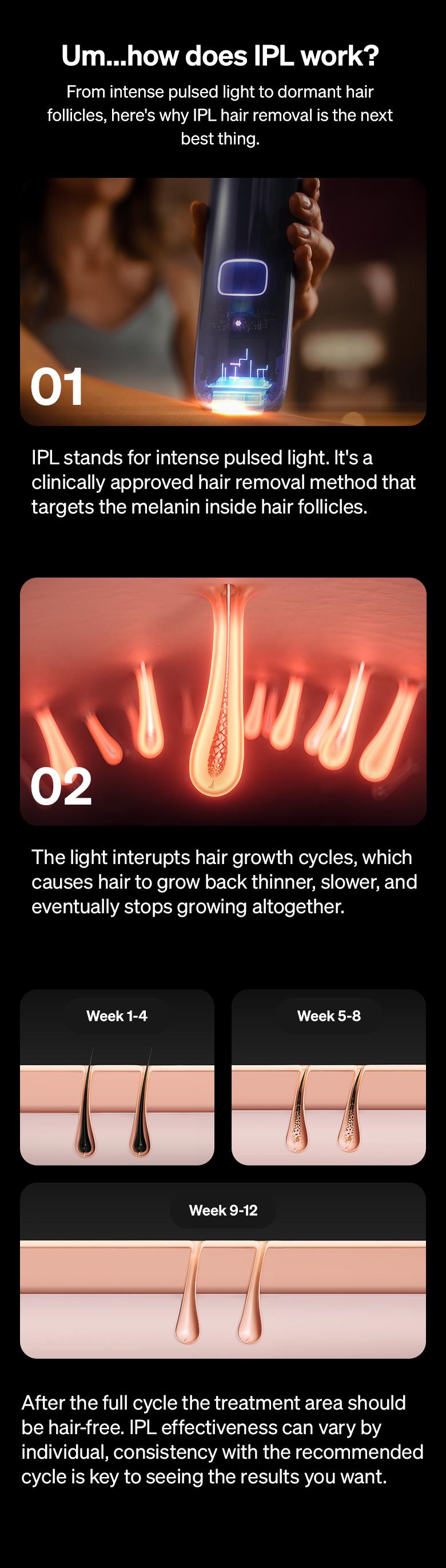 Ulike Air 3 IPL Hair Removal Device Ice-Cooling Contact & Skin Sensor for Women Men 90% Hair Reduction in 4 Weeks Comfortable Effective Hair Remover Springtok Depilator