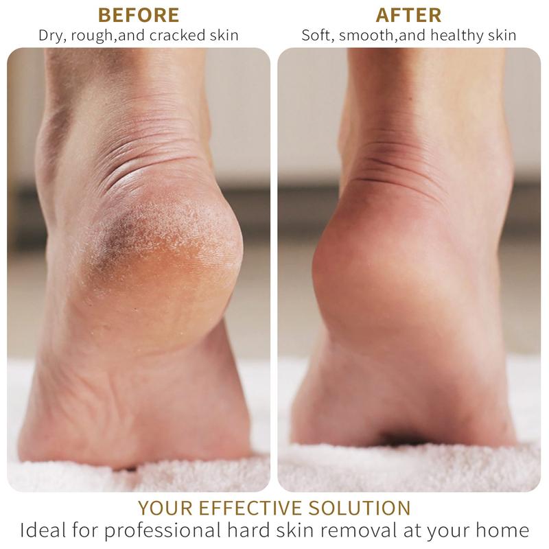 Portable Electric Foot File USB Rechargeable Pedicure Machine for Men & Women Winter Gift Callus Remover Stocking Fillers Nail Art Cutics