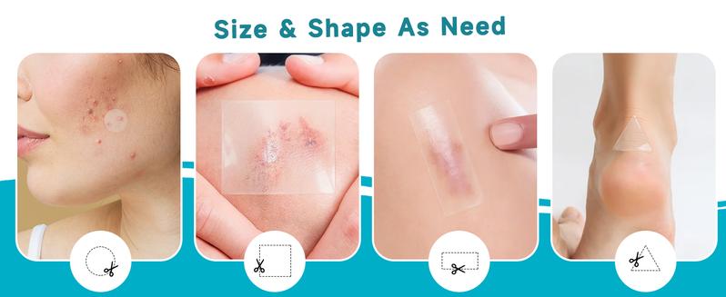 Advanced Hydrocolloid Healing Roll Patch – Medical Grade Invisible Acne & Pimple Patch Tape, Fast Skin Recovery Patch, Waterproof & Absorbent Wound Care Bandage (2in×13ft) Scar Treatment & Skin Repair