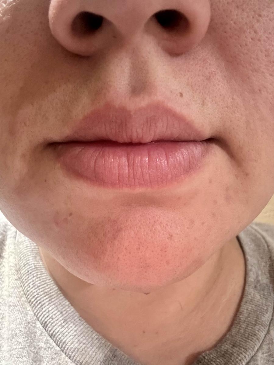 Item: Peel Shot Duo Set(white rice+ black rice)