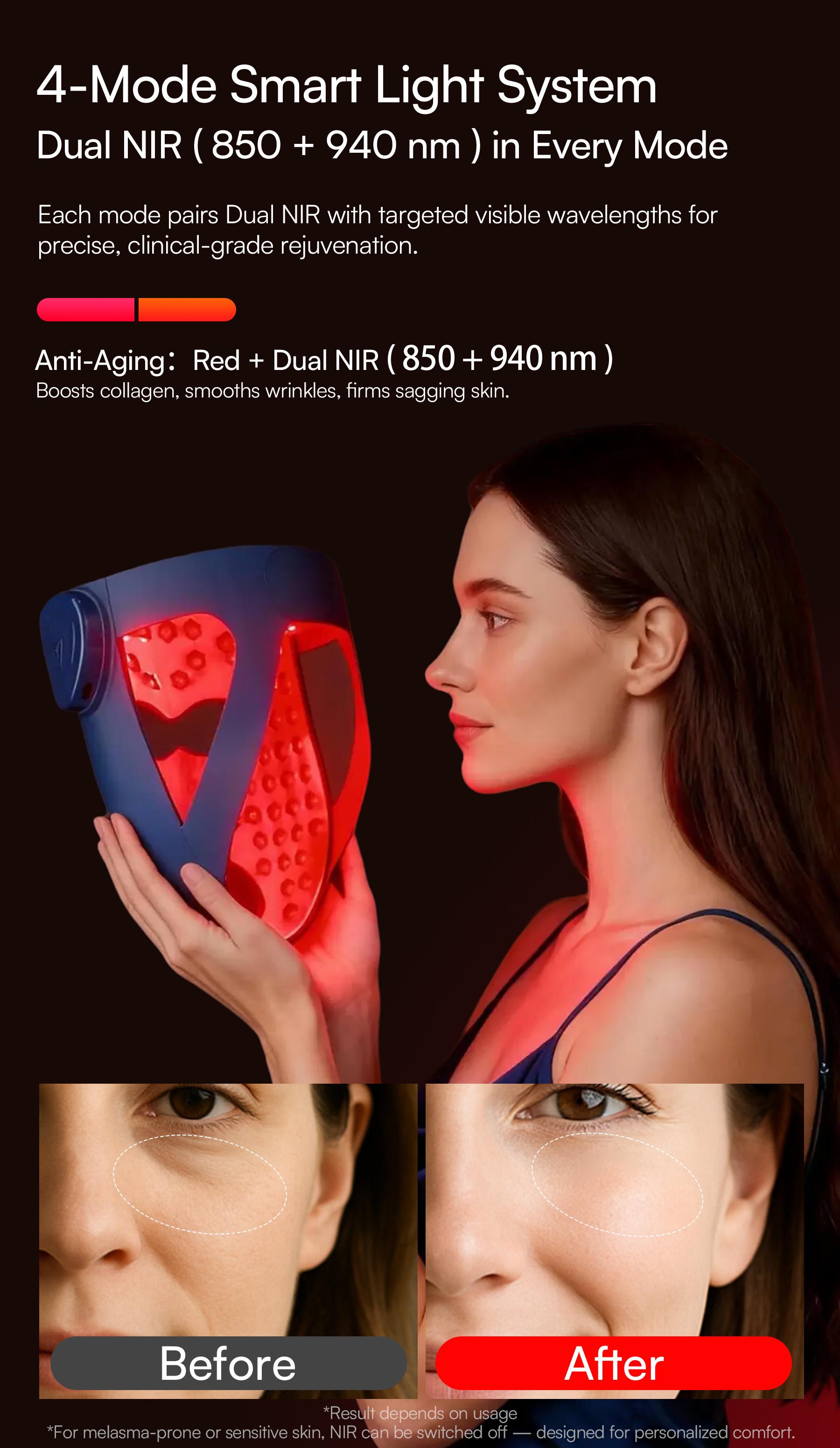 INIA GLOW 940nm 4D Face Mask & Neck Mask Bundle, Deep Dual NIR Repair (940+850nm), Cooling Therapy for Lift, Glow & Wrinkle Reduction, Face to Chest Anti-Aging