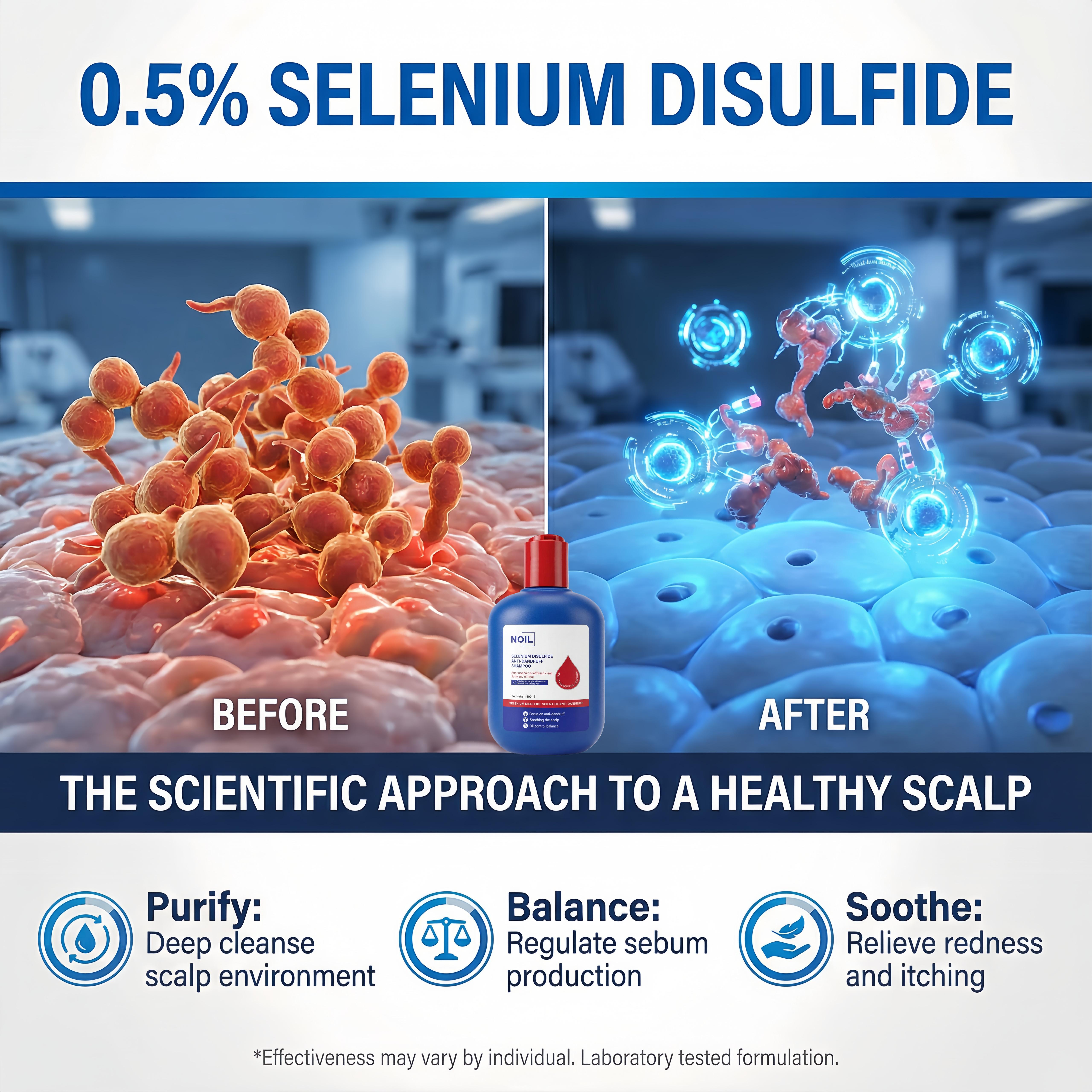 NOIL Selenium Disulfide Hair Care Shampoo Oil Control Refreshing Anti-Dandruff Anti-itch Scalp Cleansing Shampoo, 300ML