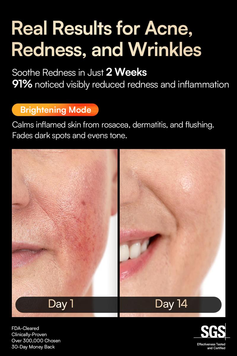 INIA GLOW Wireless LED Face Mask-With Red Light Therapy, 2-Year Warranty,  Portable and Rechargeable for LED Facial Mask Skincare at Home and Travel, Best Valentine's Day Gift for Her