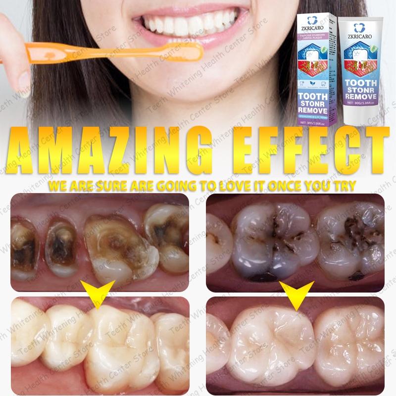 ZKRICARO Anti-Cavity Repair Toothpaste FDA Approved Strengthens Enamel Removes Plaque Tartar Relieves Sensitivity Oral Health Care ZKRICARO Anti-Cavity Repair Toothpaste FDA Approved Strengthens Enamel Removes Plaque Tartar Relieves Sensitivity Oral Health Care
