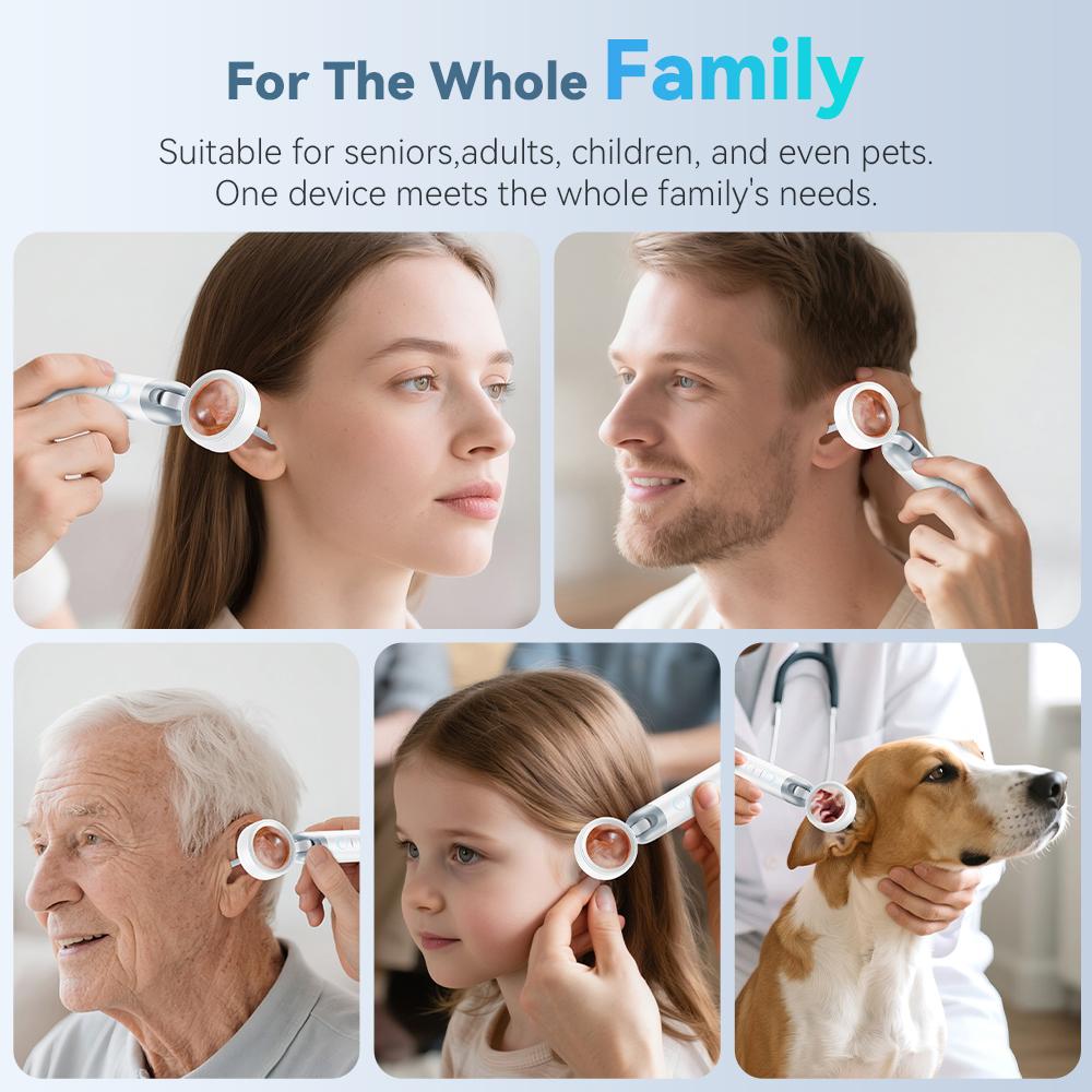 【2026 Upgrade】Aspoven Digital Otoscope with LED Light, 1.4" IPS Screen, 1080P HD Ear Scope for Kids, Adults & Pets, 12 Silicone Specula Tips, Photo & Video Recording, Type-C Rechargeable Ear Wax Removal Tool 【2026 Upgrade】Aspoven Digital Otoscope with LED Light, 1.4" IPS Screen, 1080P HD Ear Scope for Kids, Adults & Pets, 12 Silicone Specula Tips, Photo & Video Recording, Type-C Rechargeable Ear Wax Removal Tool