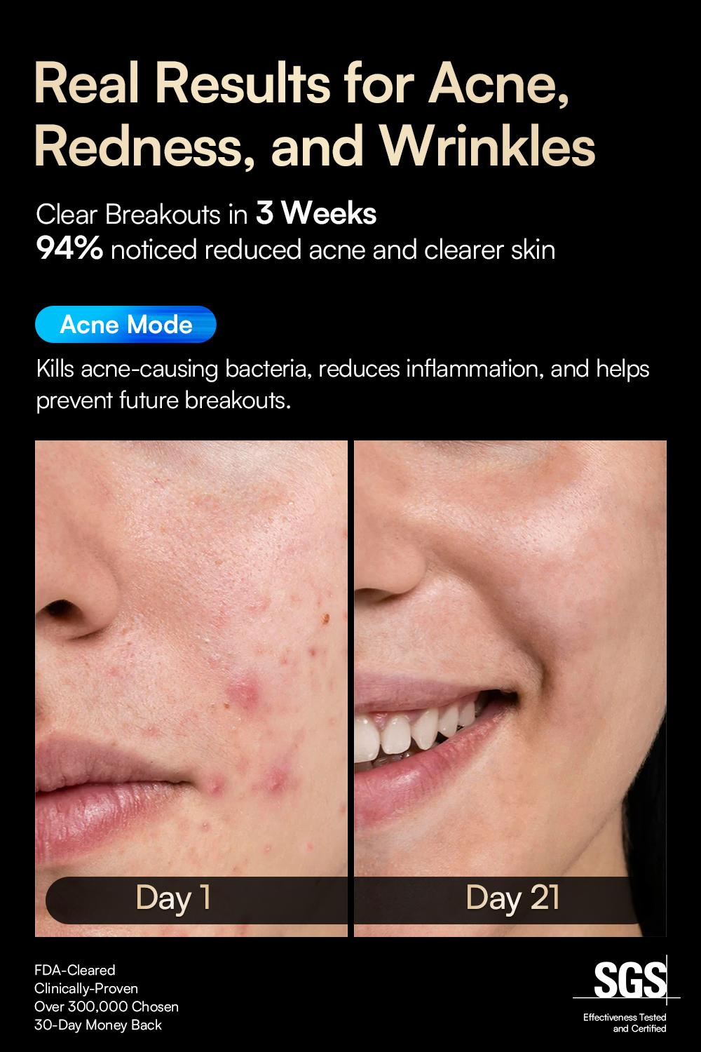 INIA GLOW Wireless LED Face Mask-With Red Light Therapy, 2-Year Warranty,  Portable and Rechargeable for LED Facial Mask Skincare at Home and Travel, Best Valentine's Day Gift for Her