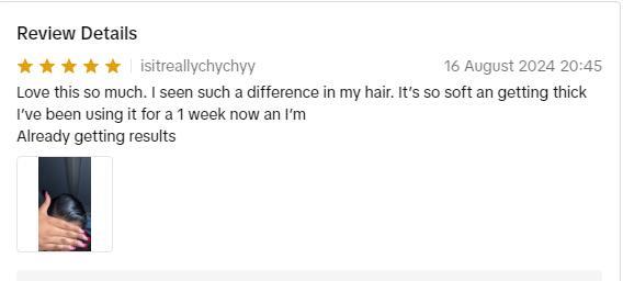 Gypsophila Batana Oil with Rosemary for Hair Growth (2pcs 60 mL),Nourish Scalp & Detox for Strong &Healthy Hair, Haircare Rosemary Oil Comfort Strengthening Serum Thickening Nourishing Organic Daily Frizz Moisture Hydrating Moisturizing Gypsophila Batana Oil with Rosemary for Hair Growth (2pcs 60 mL),Nourish Scalp & Detox for Strong &Healthy Hair, Haircare Rosemary Oil Comfort Strengthening Serum Thickening Nourishing Organic Daily Frizz Moisture Hydrating Moisturizing