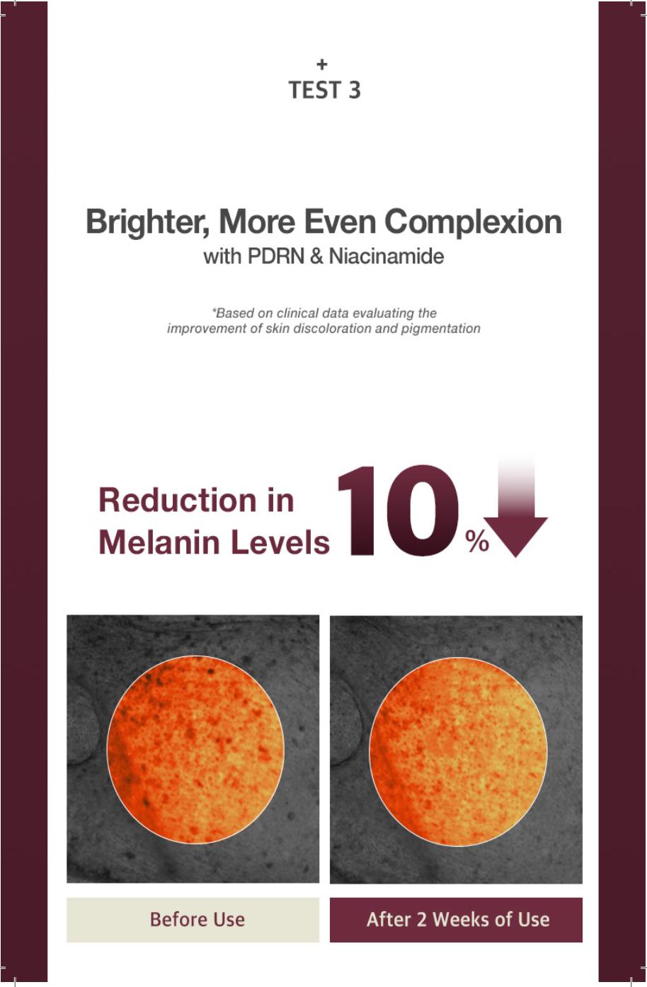 KI Stem-Cell Exosome Booster Kit + 5 Akatsuki White tomato Masks - Anti-Aging & Brightening Ampoule Set with Exosome Solution & Syringe for Radiant Skin Skincare Set Serum Essence