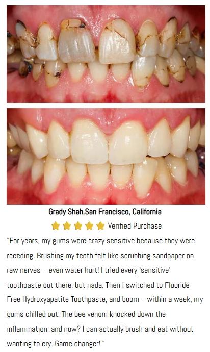 AstraGlow SP-8 toothpaste - Targets Stains for Removal, Whitens to Perfection, Battles Tooth Decay & Infuses Breath with Freshness Oral Whitening hydroxyapatitetoothpaste